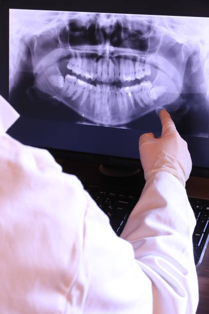 Best Knocked-Out Tooth (Avulsed Tooth) Treatment in Ida Grove, IA