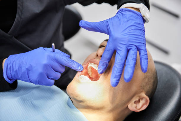 Best Dental Abscess Treatment in Ida Grove, IA